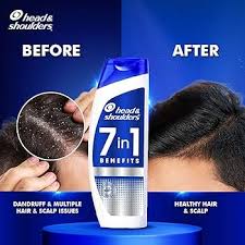 HEAD N SHOUDER 7IN1 ANTI DANDRUF SHAMPOO 180ML